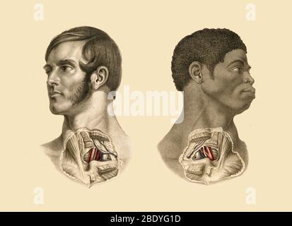 Subclavian Anatomy, Medical Illustration, 1851 Stockfoto