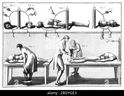 Galvanismus-Experimente, 1804 Stockfoto