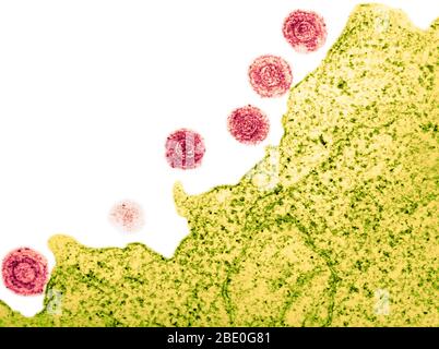 Farblich verstärkter Transmissionselektronenmikrograph (TEM) des HHV-6 (humanes Herpesvirus-6). Es wurde angenommen, dass es b-Zellen infizieren und wurde zu einer Zeit als HBLV, menschliches b-lymphotropes Virus. Es ist jetzt bekannt, T-Zellen als auch zu infizieren. Das HHV-6 ist ein doppelsträngiger DNA-Virus aus der Herpesfamilie. Die hier gezeigten Viruspartikel sind gereift und dann aus der angefallenen Lymphozyte freigesetzt. Das 'Eulenauge' der Viruspartikel ist charakteristisch für die Herpesfamilie. Stockfoto