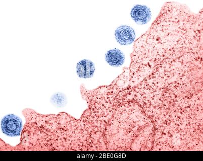 Farblich verstärkter Transmissionselektronenmikrograph (TEM) des HHV-6 (humanes Herpesvirus-6). Es wurde angenommen, dass es b-Zellen infizieren und wurde zu einer Zeit als HBLV, menschliches b-lymphotropes Virus. Es ist jetzt bekannt, T-Zellen als auch zu infizieren. Das HHV-6 ist ein doppelsträngiger DNA-Virus aus der Herpesfamilie. Die hier gezeigten Viruspartikel sind gereift und dann aus der angefallenen Lymphozyte freigesetzt. Das 'Eulenauge' der Viruspartikel ist charakteristisch für die Herpesfamilie. Stockfoto