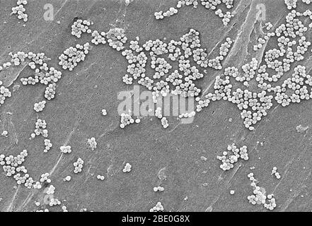 Diese Rasterelektronenmikrographie zeigt eine Gruppierung von Methicillin-resistenten Staphylococcus aureus (MRSA) Bakterien. Sie stammen aus einem der ersten Isolate in den USA, die eine erhöhte Resistenz gegen Vancomycin zeigten. Beachten Sie die Zunahme von Zellwandmaterial, das als Klumpen auf der Oberfläche des Organismus gesehen wird. Kürzlich erkannte Ausbrüche oder Cluster von MRSA in Gemeinschaftsbereichen wurden mit Stämmen assoziiert, die im Vergleich zu den traditionellen krankenhausbasierten MRSA-Stämmen einige einzigartige mikrobiologische und genetische Eigenschaften aufweisen. Dies legt nahe, dass einige biologische Eigenschaften, z. B. Virulenz Faktoren li Stockfoto