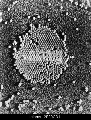 Polio-Virus, TEM Stockfotografie - Alamy