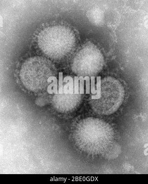 Negativ gefärbte Transmissionselektronenmikrographie (TEM) einiger ultrastruktureller Morphologie des A/CA/4/09 Schweinegrippe-Virus. Schweinegrippe (Schweinegrippe) ist eine Atemwegserkrankung von Schweinen, die durch das Typ-A-Grippevirus verursacht wird und regelmäßig zu einem Grippeausbruch bei Schweinen führt. Schweinegrippe-Viren verursachen hohe Krankheitswerte und niedrige Todesraten bei Schweinen. Schweinegrippeviren können das ganze Jahr über unter den Schweinen zirkulieren, aber die meisten Ausbrüche treten in den späten Herbst- und Wintermonaten auf, ähnlich wie Ausbrüche beim Menschen. Das klassische Schweinegrippe-Virus (ein Influenza-Typ-A-H1N1-Virus) war das erste Isol Stockfoto