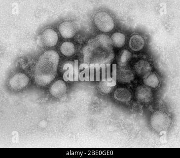 Negativ gefärbte Transmissionselektronenmikrographie (TEM) einiger ultrastruktureller Morphologie des A/CA/4/09 Schweinegrippe-Virus. Schweinegrippe (Schweinegrippe) ist eine Atemwegserkrankung von Schweinen, die durch das Typ-A-Grippevirus verursacht wird und regelmäßig zu einem Grippeausbruch bei Schweinen führt. Schweinegrippe-Viren verursachen hohe Krankheitswerte und niedrige Todesraten bei Schweinen. Schweinegrippeviren können das ganze Jahr über unter den Schweinen zirkulieren, aber die meisten Ausbrüche treten in den späten Herbst- und Wintermonaten auf, ähnlich wie Ausbrüche beim Menschen. Das klassische Schweinegrippe-Virus (ein Influenza-Typ-A-H1N1-Virus) war das erste Isol Stockfoto