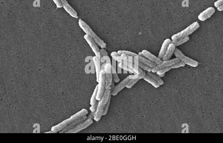 Rasterelektronenmikrograph SEM) einer Reihe einer großen Gruppe von gramnegativen Legionella pneumophila-Bakterien. Beachten Sie die Anwesenheit von polaren Geißeln und Pili, oder lange Streamer. Eine Reihe dieser Bakterien scheinen eine längliche Stäbchen Morphologie zeigen. L. pneumophila sind bekannt, dass diese Konfiguration am häufigsten zeigen, wenn sie in Brühe gewachsen sind, aber sie können auch verlängern, wenn Platte-gewachsene Zellen altern, wie es in diesem Fall war, vor allem, wenn sie gekühlt wurden. Die übliche L. pneumophila-Morphologie besteht aus stout, 'fetten' Bazillen, was bei der überwiegenden Mehrheit der Organismen der Fall ist Stockfoto