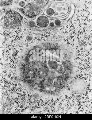 Transmissionselektronenmikrograph (TEM) von Lysosomen. Ein Lysosososososum ist ein membrangebundenes Organell, das in fast allen tierischen Zellen gefunden wird. Es sind kugelförmige Vesikel, die hydrolytische Enzyme enthalten, die praktisch alle Arten von Biomolekülen (Abfallstoffe und Zellreste) abbauen können. Der Name lysosome leitet sich von den griechischen Wörtern lysis, zu trennen und soma, Körper ab. Sie werden häufig als "Suizid-Beutel" oder "Suizid-Beutel" von Zellbiologen wegen ihrer Rolle in der Autolyse, besser bekannt als Selbstverdauung, bezieht sich auf die Zerstörung einer Zelle durch die Wirkung ihrer eigenen Enzyme Spitznamen. Magni Stockfoto