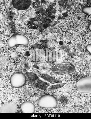 Transmissionselektronenmikrograph (TEM) von Lysosomen. Ein Lysosososososum ist ein membrangebundenes Organell, das in fast allen tierischen Zellen gefunden wird. Es sind kugelförmige Vesikel, die hydrolytische Enzyme enthalten, die praktisch alle Arten von Biomolekülen (Abfallstoffe und Zellreste) abbauen können. Der Name lysosome leitet sich von den griechischen Wörtern lysis, zu trennen und soma, Körper ab. Sie werden häufig als "Suizid-Beutel" oder "Suizid-Beutel" von Zellbiologen wegen ihrer Rolle in der Autolyse, besser bekannt als Selbstverdauung, bezieht sich auf die Zerstörung einer Zelle durch die Wirkung ihrer eigenen Enzyme Spitznamen. Magni Stockfoto