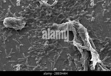 Scanning Electron Micrograph (SEM) zeigt Legionella pneumophila auf Biofilm; Vergrößerung: 3200X. Dieser Organismus ist der Erreger der Legionärskrankheit. Stockfoto