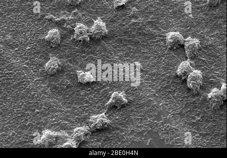 Rasterelektronenmikrograph (SEM) zeigt ultrastrukturelle Morphologie, die von einer Reihe von Vermamoeba vermiformis (Hartmannella) Amöben trophozoiten gezeigt wurde. Im Rahmen einer Studie, ob Legionella pneumophila Bakterien in Biofilmen mit oder ohne V. vermiformis besiedeln und wachsen können, wurden diese Protozoen hier auf einem Basisbiofilm aus Pseudomonas aeruginosa, Klebsiella pneumoniae und Flavobacterium sp. Bakterien aufgestellt. Beachten Sie, dass die Amöben grasen auf diese Bakterien, die die durchforstet Edelstahl Coupon Oberfläche zeigt. Vermamoeba vermiformis ein frei-l Stockfoto