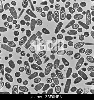 Transmission Electron Micrograph (TEM) von Bacillus subtilis Bakterien. Bacillus subtilis, auch Heubacillus oder Grasbacillus genannt, ist ein Gram-positives, katalogasespositives Bakterium, das im Boden und im Magen-Darm-Trakt von Wiederkäuern und Menschen vorkommt. B. subtilis, ein Mitglied der Gattung Bacillus, ist stabförmig und kann ein zähes, schützendes Endospore bilden, das es extremen Umweltbedingungen toleriert. B. subtilis wurde historisch als obligat Aerobe eingestuft, obwohl es Beweise dafür gibt, dass es sich um einen fakultativen Aerobe handelt. B. subtilis gilt als das am besten untersuchte Gram-positive Stockfoto