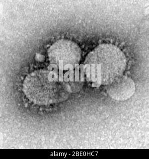 Negativ-fleckige Transmissionselektronenmikrographie (TEM) des Middle East Respiratory Syndrome Coronavirus (MERS-CoV), einem neuartigen Coronavirus (nCoV), das erstmals am 24. September 2012 vom ägyptischen Virologen Dr. Ali Mohamed Zaki in Jeddah, Saudi-Arabien, berichtet wurde. Er isolierte und identifizierte ein bisher unbekanntes Coronavirus aus der Lunge eines 60-jährigen männlichen Patienten mit akuter Lungenentzündung und akuter Niereninsuffizienz. MERS-CoV ist die sechste neue Art von Coronavirus wie SARS (aber immer noch von ihm und dem gemeinsamen kalten Coronavirus unterschieden). Virions enthalten charakteristische clubähnliche Projektionen, die von der ausgehen Stockfoto