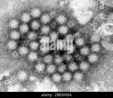 Dieser Transmissionselektronenmikrograph (TEM) zeigte einige der ultrastrukturellen Morphologie, die von Norovirus-Virionen oder Viruspartikeln dargestellt wurde. Noroviren gehören zur Gattung Norovirus und zur Familie Caliciviridae. Sie sind eine Gruppe von verwandten, einsträngigen RNA, unbehüllten Viren, die akute Gastroenteritis beim Menschen verursachen. Norovirus wurde kürzlich als offizieller Genus-Name für die Gruppe der Viren zugelassen, die vorläufig als Norwalk-like Virus (NLV) beschrieben werden. Stockfoto