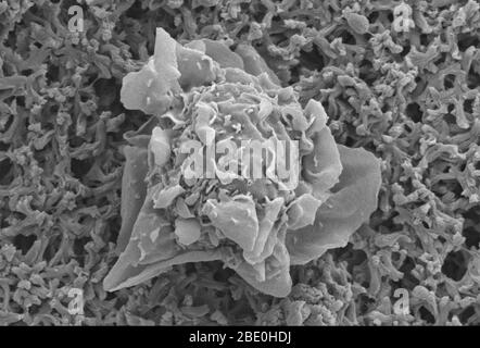 Scanning Electron Micrograph (SEM) zeigt eine unreife dendritische Zelle. Dendritische Zellen (DCs) sind Antigen-präsentierende Zellen (Zusatzzellen) des Säugetierimmunsystems. Ihre Hauptfunktion ist es, Antigen-Material zu verarbeiten und es auf der Zelloberfläche den T-Zellen des Immunsystems zu präsentieren. Sie wirken als Boten zwischen dem angeborenen und dem adaptiven Immunsystem. Dendritische Zellen sind in jenen Geweben vorhanden, die mit der äußeren Umgebung in Kontakt sind, wie die Haut und die innere Auskleidung der Nase, der Lunge, des Magens und des Darms. Sie können auch in einem unreifen Zustand in der b gefunden werden Stockfoto