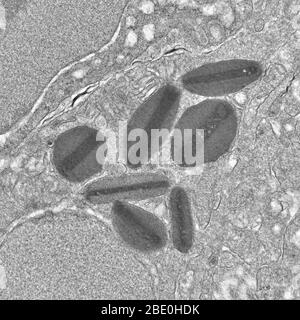 Transmission Electron Mikrograph zeigt Eosinophilgranulat, eine Art weißer Blutkörperchen. Eosinophile, manchmal auch Eosinophile oder, weniger häufig, Azidophilen genannt, sind eine Vielzahl von weißen Blutkörperchen und eine der Komponenten des Immunsystems, die für die Bekämpfung von mehrzelligen Parasiten und bestimmten Infektionen bei Wirbeltieren verantwortlich sind. Neben Mastzellen und Basophilen steuern sie auch Mechanismen, die mit Allergie und Asthma assoziiert sind. Es sind Granulozyten, die sich während der Hämatopoiese im Knochenmark entwickeln, bevor sie in das Blut wandern. Vergrößerung unbekannt. Stockfoto