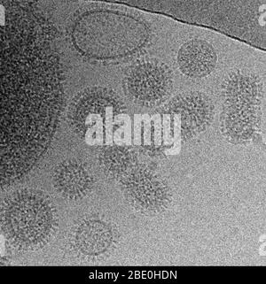 Kryo-EM-Bild des Influenza A (H1N1)-Virus, PR8-Stamm. Influenza A (H1N1) ist der Subtyp des Influenza A-Virus, der die häufigste Ursache der menschlichen Influenza (Grippe) war und mit dem Ausbruch der spanischen Grippe von 1918 in Verbindung steht. 2009 erklärte die Weltgesundheitsorganisation (WHO) den neuen Stamm der H1N1-Sorte mit Schweinebrippe als Pandemie. Diese Sorte wird von den öffentlichen Medien oft Schweinegrippe genannt. Dieses neuartige Virus verbreitete sich weltweit und hatte Anfang 2010 etwa 17,000 Todesfälle verursacht. Im Jahr 2010 erklärte DIE WHO, dass die H1N1-Grippepandemie vorbei sei, und sagte, dass die weltweite Grippeaktivität zurückgekehrt sei Stockfoto