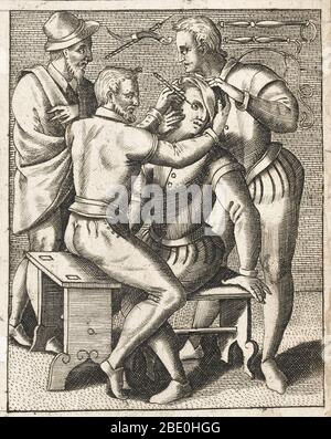 Der Patient wird während einer Operation am Auge festgehalten, 1594. Im Hintergrund sind Abbildungen vieler ophthalmischer chirurgischer Werkzeuge. Stockfoto