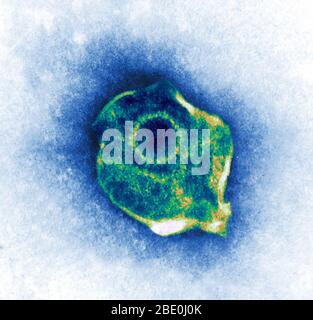 Farblich verbesserte Transmissionselektronenmikrographie (TEM) des Herpes Simplex Virus. Stockfoto