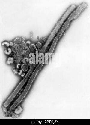 Negativ gefärbte Transmission Electron Microscopic (TEM)-Aufnahme zeigte das Vorhandensein einer Reihe von Influenza-Virus-Virionen. Dieses Virus ist ein Familienmitglied des Orthomyxoviridae-Virus. Die Orthoomyxoviren sind eine Familie von RNA-Viren, die sieben Gattungen umfasst: Influenza-Virus A, Influenza-Virus B, Influenza-Virus C, Influenza-Virus D, Isavirus, Thogotovirus und Quaranjavirus. Die ersten drei Gattungen enthalten Viren, die bei Wirbeltieren, einschließlich Vögeln (siehe auch Vogelgrippe), Menschen und anderen Säugetieren, eine Influenza verursachen. Influenza A- und B-Viren verursachen saisonale Seuchenepidemien fast jedes wi Stockfoto