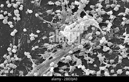 Das Scan-Elektronenmikrograph (SEM)-Bild eines Staphylococcus-Biofilms basierte auf der Kultur, die von der inneren Oberfläche eines nadellosen Steckverbinders gewonnen wurde. Ein Biofilm ist eine Gruppe von Mikroorganismen, in denen Zellen aneinander haften und oft auch an einer Oberfläche. Diese adhärenten Zellen werden in eine schleimige extrazelluläre Matrix eingebettet, die aus extrazellulären polymerischen Substanzen (EPS) besteht. Die EPS-Komponenten werden von den Zellen im Biofilm produziert und sind typischerweise eine polymerische Konglomeration von extrazellulärer DNA, Proteinen und Polysacchariden. Diese Polysaccharide wurden visualisiert b Stockfoto