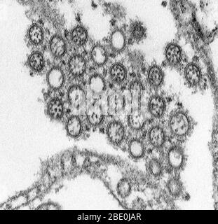 Transmission Electron Micrograph (TEM), der die Anzahl der Virionen aus einem neuartigen Grippe H1N1 Isolat darstellt. Das neuartige H1N1 (früher als „Weingrippe“ bezeichnet) ist ein neues Grippevirus, das bei Menschen Krankheiten verursacht. Dieses neue Virus wurde erstmals im April 2009 bei Menschen in den Vereinigten Staaten entdeckt. Dieses Virus breitet sich weltweit von Mensch zu Mensch aus, wahrscheinlich in der gleichen Weise wie sich regelmäßige saisonale Grippeviren ausbreiten. Am 11. Juni 2009 signalisierte die Weltgesundheitsorganisation (WHO), dass eine Pandemie der neuartigen H1N1-Grippe im Gange sei. Dieses Virus wurde ursprünglich als "Weingrippe" bezeichnet, weil Laborator Stockfoto