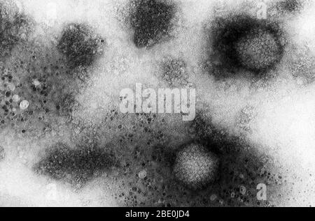 Transmission Electron Micrograph (TEM) zeigt einige der ultrastrukturellen Morphologie, die von zwei Adenovirus-2-Virionen gezeigt wird. Die Probe war pelletiert worden, wodurch die viralen Partikel vor der Betrachtung unter dem Mikroskop konzentriert wurden. Bei dieser hohen Vergrößerung sind die Kapseligkeit sichtbar, die in diesem Fall hexagonal geformt, auch Hexonen genannt, und die zusammen die äußere Hülle des Adenovirus, das als Capsid bekannt ist, umfasste. Diese Adenoviren zeigten eine Ikosaedrale Symmetrie, was bedeutet, dass die Form durch 12 Scheitelpunkte und 20 Facetten charakterisiert wurde. Jedes Virion war 70nm-80nm, A Stockfoto