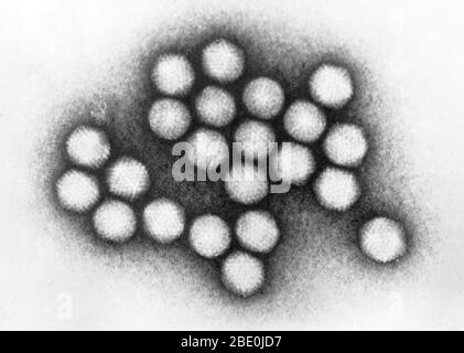 Transmission Electron Micrograph (TEM) von Adenovirus-Partikeln. Adenoviren (Mitglieder der Familie Adenoviridae) sind unbehüllte Viren mit einem Icosaedral Nukleokapsid, das ein doppelsträngiges DNA-Genom enthält. Adenovirus-Infektionen verursachen meist Erkrankungen der Atemwege, können aber je nach infizierender Serotyp auch verschiedene andere Erkrankungen und Präsentationen verursachen. Neben der Beteiligung der Atemwege, Erkrankungen und Präsentationen von Adenovirus gehören Gastroenteritis, Konjunktivitis, Zystitis und Ausschlag Krankheit. Symptome einer Atemwegserkrankung durch Adenovirus i Stockfoto