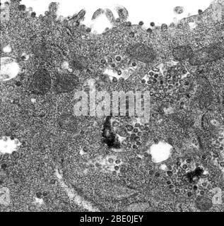 Transmission Electron Micrograph (TEM) eines dünnen TEM-Abschnitts einer infizierten Vero E6-Zelle, der das Vorhandensein von Coronavirus-Partikeln aufdeckt. Beachten Sie, dass die viralen Partikel innerhalb der zytoplasmatischen Membran-gebundenen Vakuolen der Zelle und Zisternen des rauen endoplasmatischen Retikulums enthalten sind. Vero-Zellen sind eine Linie von Zellen, die in Zellkulturen verwendet werden. Coronaviren sind Arten von Viren, die zur Unterfamilie Coronavirinae in der Familie Coronaviridae, in der Reihenfolge Nidovirales gehören. Coronaviren sind eingehüllte Viren mit einem positiv-Sinn-Single-strängten RNA-Genom und mit einem Nukleokapsid von Helical symm Stockfoto