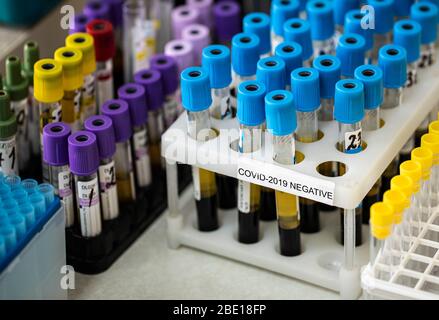 Halter mit Probenröhrchen, die mit Coronavirus kontaminiert sind und negative Ergebnisse zeigen Stockfoto