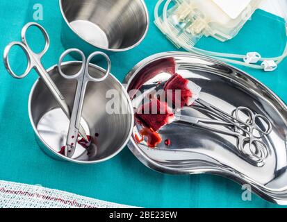 Chirurgische Schere mit torundas getränkt mit Blut auf einem Tablett Metall in einem Operationssaal, Zusammensetzung horizontale, konzeptionelle Bild Stockfoto