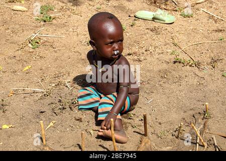 Karo Tribe Kleinkind mit laufender Nase draußen auf dem Boden Stockfoto