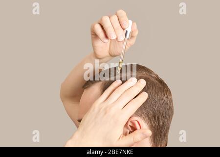 Behandlung der Kahlheit des Menschen. Naturhaarpflege Stockfoto