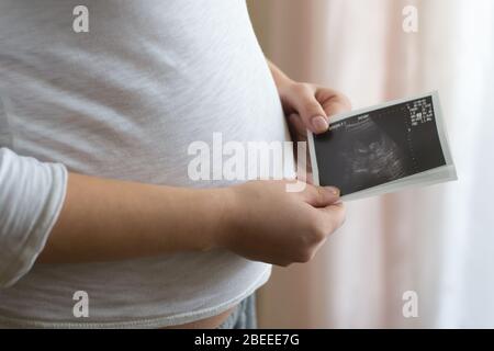 Schwangere Frau mit Ultraschallbild ihres Kindes Stockfoto