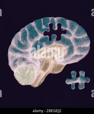 Fehlendes Hirnstück Stockfoto