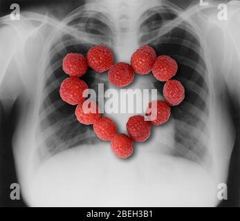 Himbeeren, Herzgesunde Früchte Stockfoto