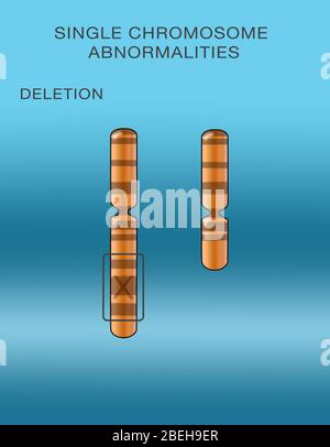 Chromosomenlöschung, Abbildung Stockfoto