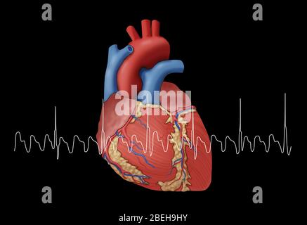 Vorhofflattern mit EKG, Illustration Stockfoto