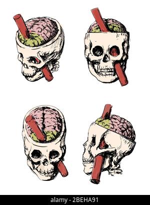 Eine Illustration der Hirnverletzung von Phineas Gage. Phineas P. Gage, 1823-1860, war ein amerikanischer Eisenbahnarbeiter, der einen Unfall 1848 überlebte, in dem ein großer Eisenstab durch seinen Kopf gefahren wurde. Der Eisenstab zerstörte den größten Teil seines linken Frontallappen. Die Auswirkungen der Verletzung auf seine Persönlichkeit wurden viel diskutiert, da es kaum schriftliche Beweise dafür gibt, was sein Verhalten tatsächlich für die zwölf verbleibenden Jahre seines Lebens war. Stockfoto