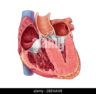 Hypertrophe Kardiomyopathie Stockfoto