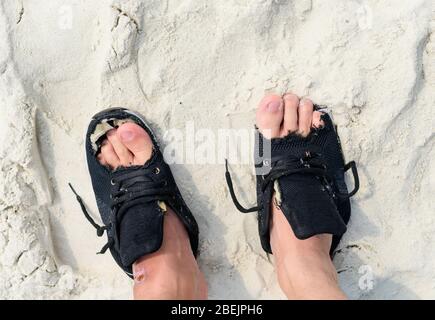 Alte Schuhe an den Füßen mit menschlichen Fingern in Löchern Stockfoto