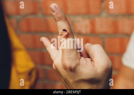 Blutendes Blut aus der Schnittwunde. Verletzter Finger mit blutender offener Schnittwunde. Nahaufnahme des Fingers menschliche Hand ist geschnitten verletzt Blutung mit hellen r Stockfoto