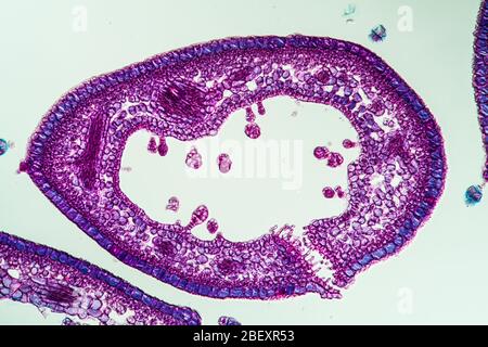 Heather-Blattquerschnitt unter dem Mikroskop, 200x Stockfoto
