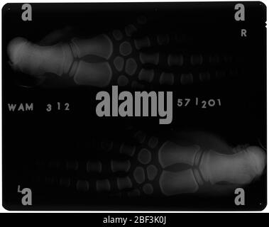 Kogia sima Owen 1866. November 20191 Stockfoto