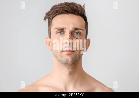 Junger Mann mit Markierungen auf seinem Gesicht vor hellem Hintergrund. Konzept der plastischen Chirurgie Stockfoto