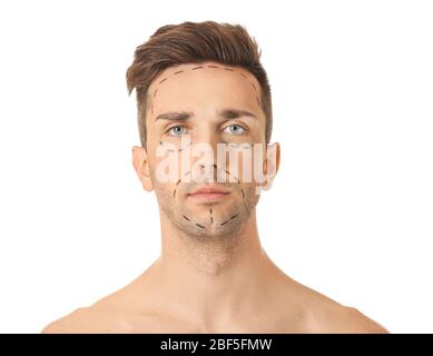 Junger Mann mit Markierungen auf seinem Gesicht vor weißem Hintergrund. Konzept der plastischen Chirurgie Stockfoto