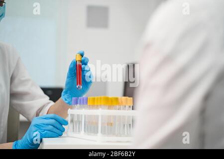 Nahaufnahme der weiblichen Hand, die Blutprobe hält Stockfoto