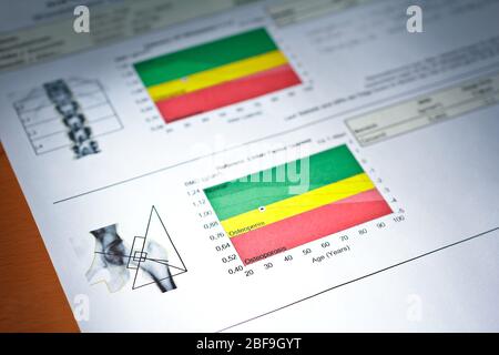 Bilder von dxa Knochendichte-Scan bei einer Frau von 42 Jahren, um Osteoporose zu verhindern. Stockfoto