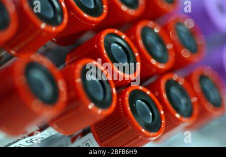 Proben von Blutspenden in Vacutainer Reagenzgläser mit roten Spitzen Stockfoto