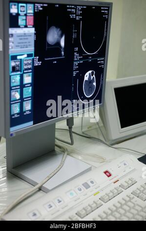 Control Panel und Kontrollbildschirm einer Computertomographie (CT)-Scan-Maschine. Stockfoto