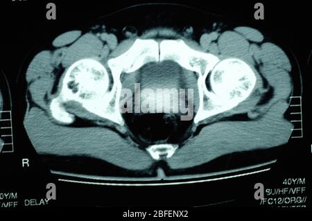 Ein Scan des Fortpflanzungssystems einer Frau Stockfoto