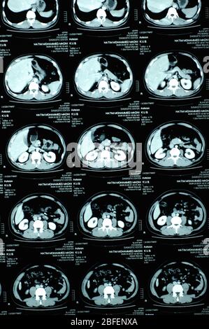 Ein Scan des Fortpflanzungssystems einer Frau Stockfoto